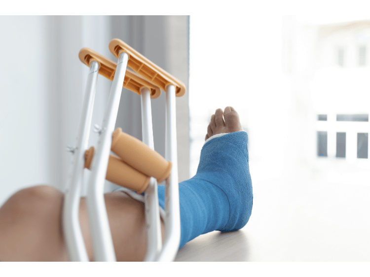 Broken Leg Workers Comp